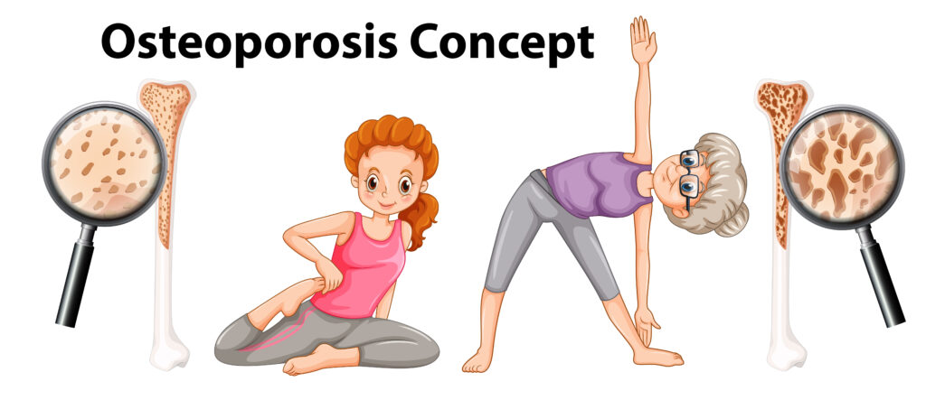 Osteoporosis